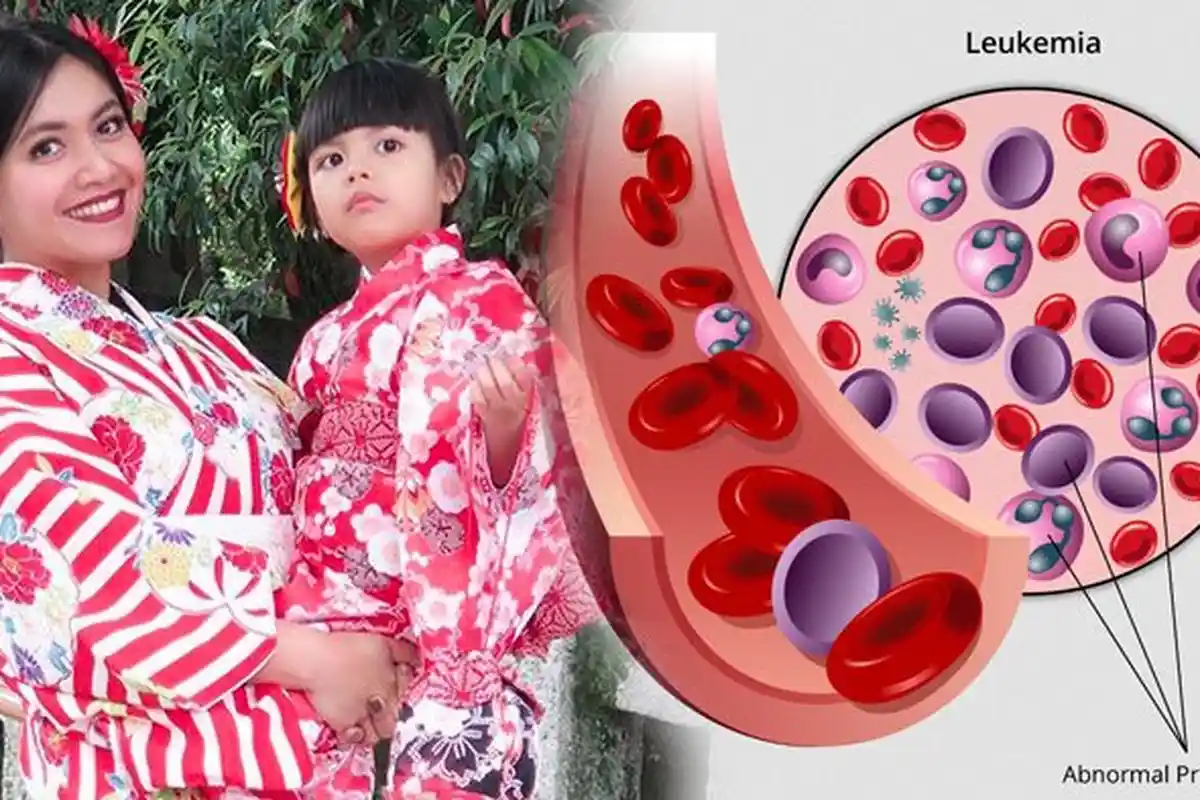 Diderita Anak Denada, Leukimia Ternyata Bisa Dicegah Pakai 5 Bahan Alami Berikut
