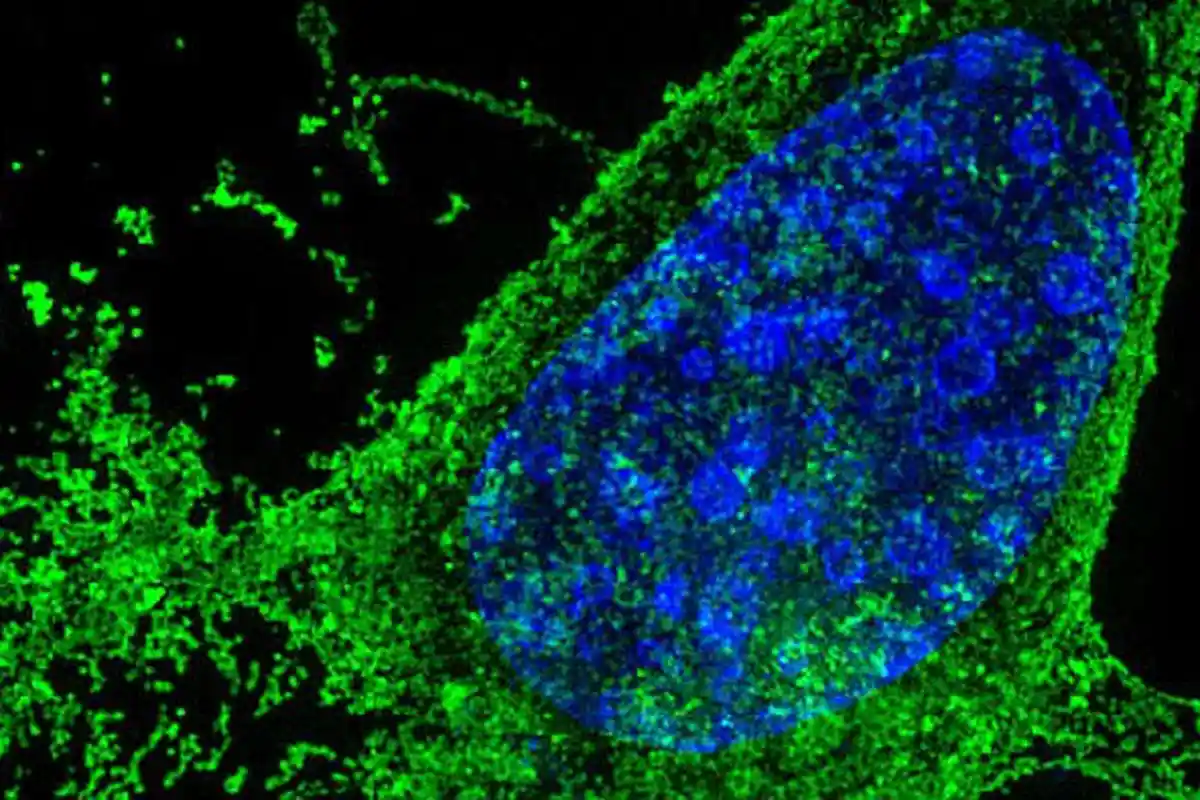 Modifikasi Gen untuk Pertama Kalinya Sembuhkan HIV pada Hewan Hidup
