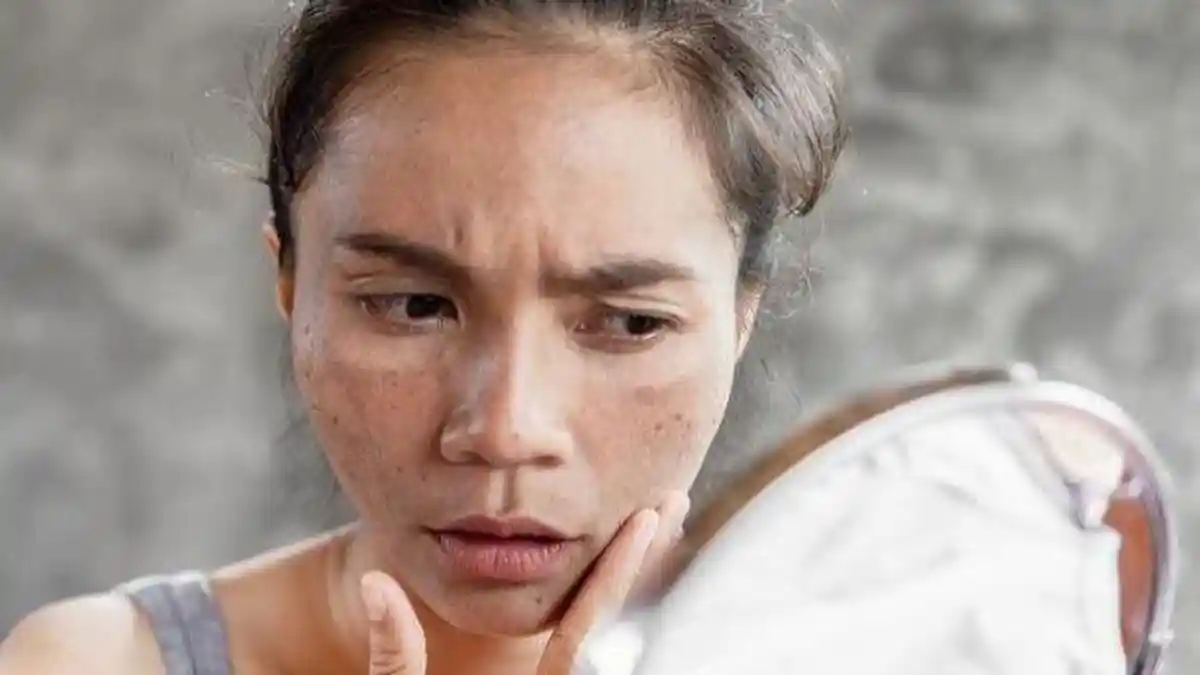 Efek Polusi Udara Pada Kulit dan 4 Cara Mencegahnya