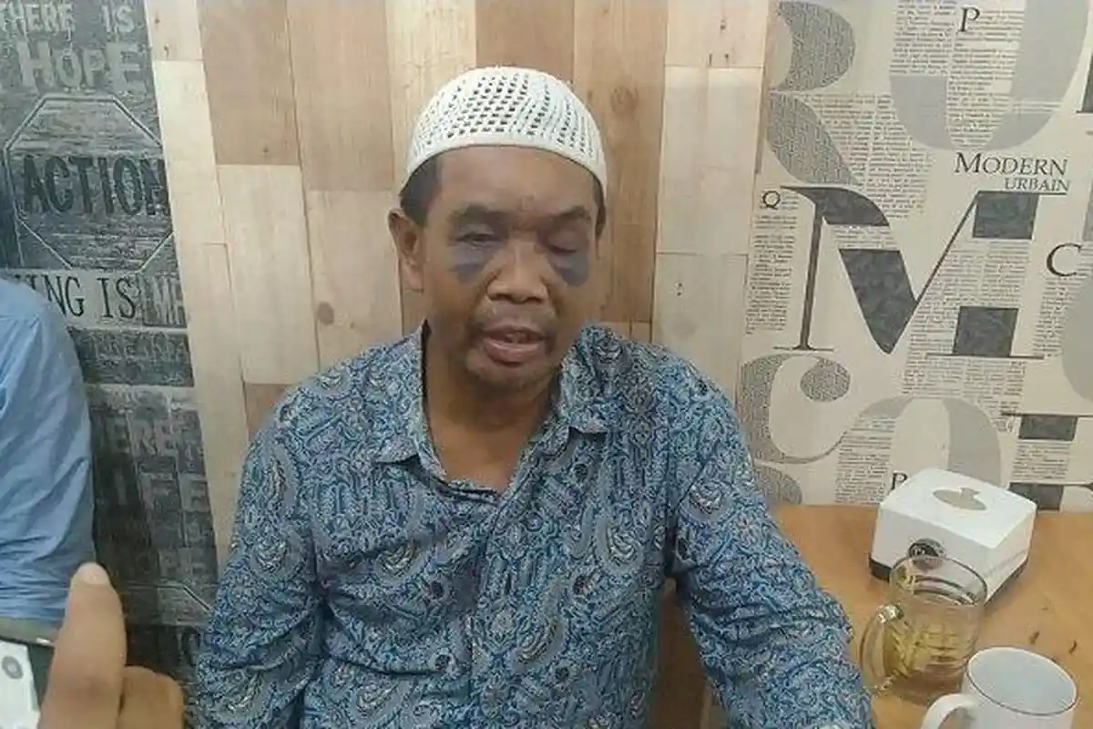 LBH Medan Sebut Saksi Diduga Dianiaya Oknum Polisi Langgar HAM, Sarpan: Sebut Anjas, Awak Ditendang