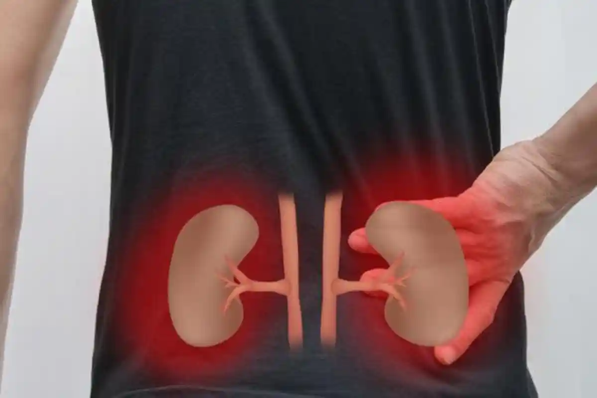 Penyebab Ginjal Bengkak