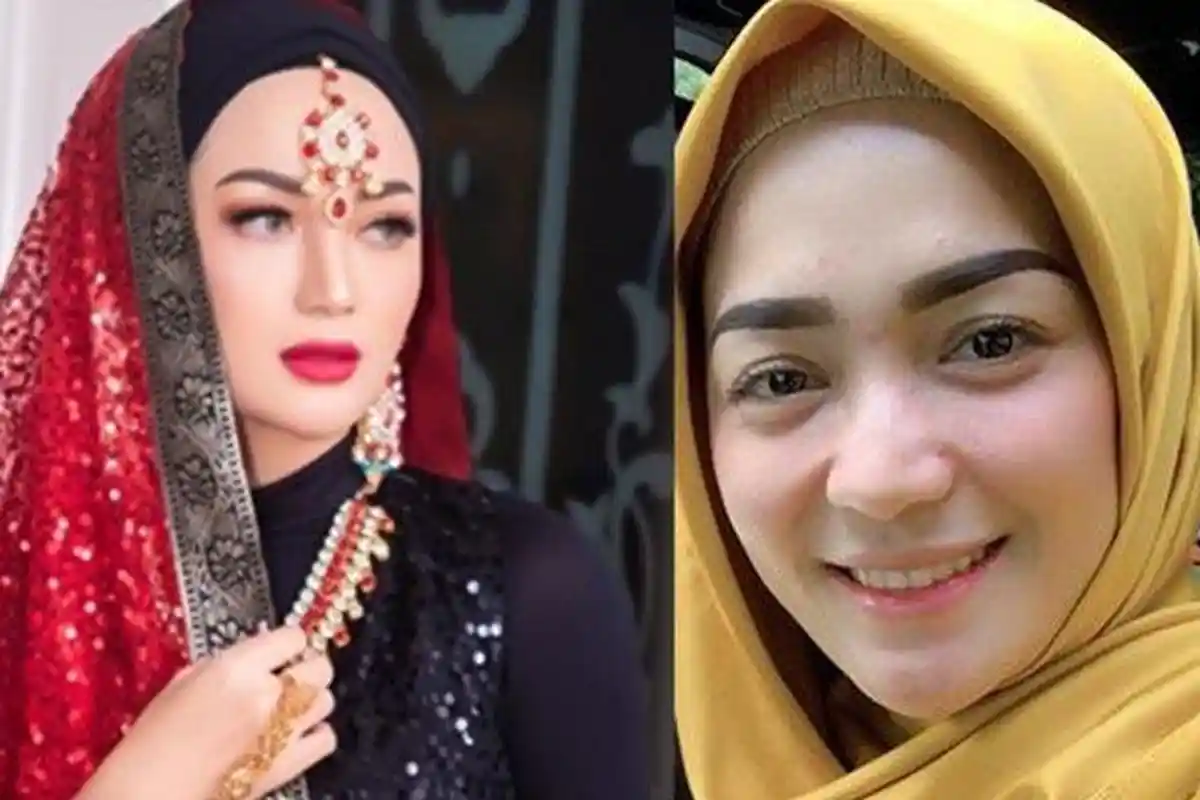 Haru! Imel Putri Cahyati Masih Positif Covid-19, Ibundanya Menangis tak Ingin Anaknya Ditinggal