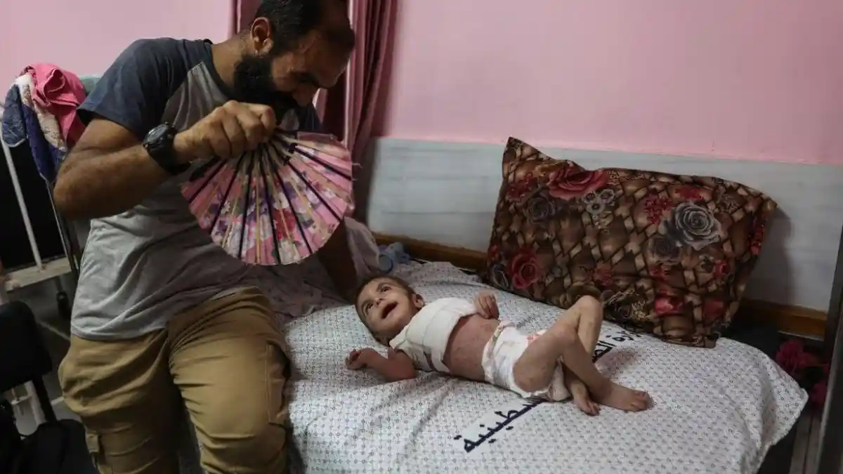 Penyakit Kulit Menyerang Anak-anak di Gaza, Rasa Gatal Menyiksa Sepanjang Malam