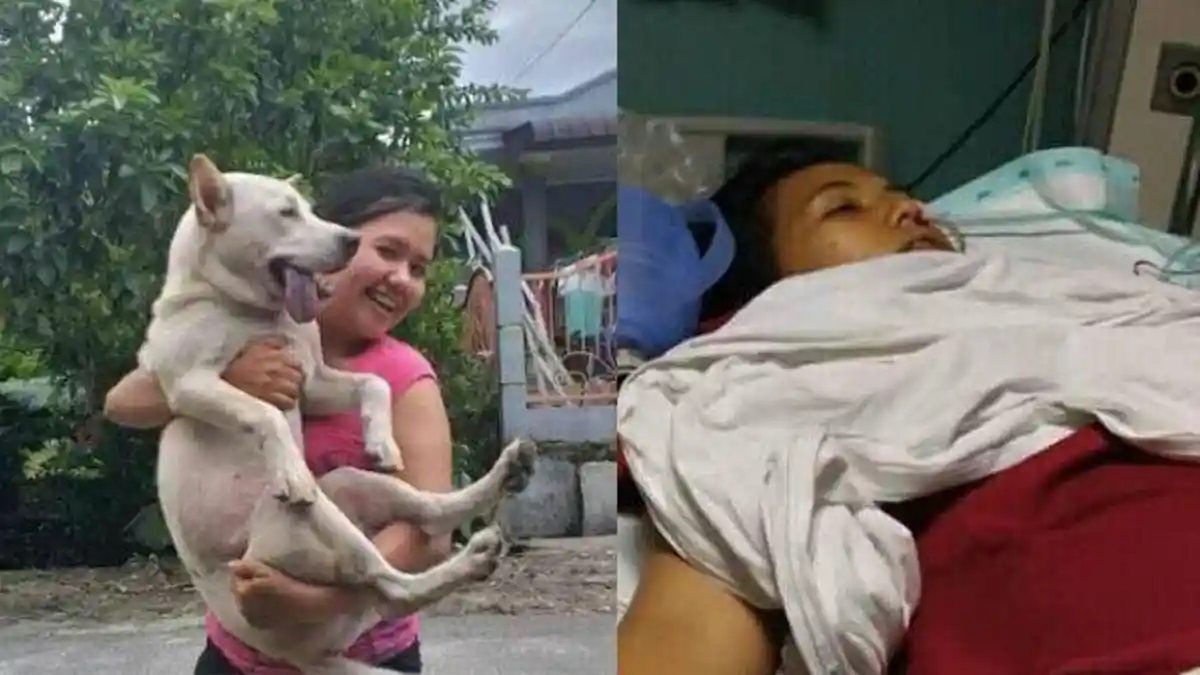 Gadis Pematang Siantar Ini Meninggal Setelah Digigit Anjing Kesayangan, Begini Kronologinya