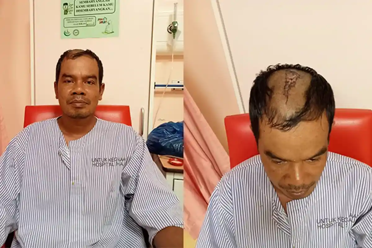 TKI Asal Aceh Tamiang yang Kecelakaan Kerja Dirawat di Malaysia, Butuh Bantuan untuk Pulang Kampung