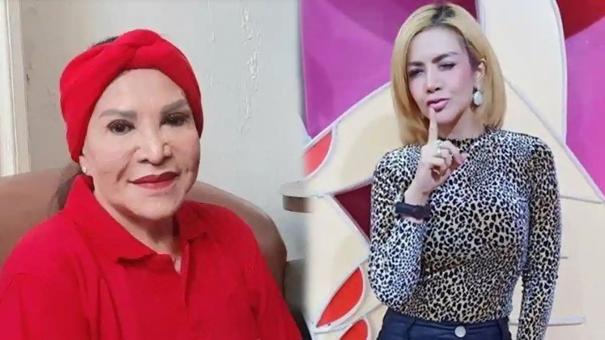 5 Artis Oplas tapi Gagal, Hidung Miring & Bernanah, Ngaku Efek Dipukuli karena Malu Hasilnya Aneh