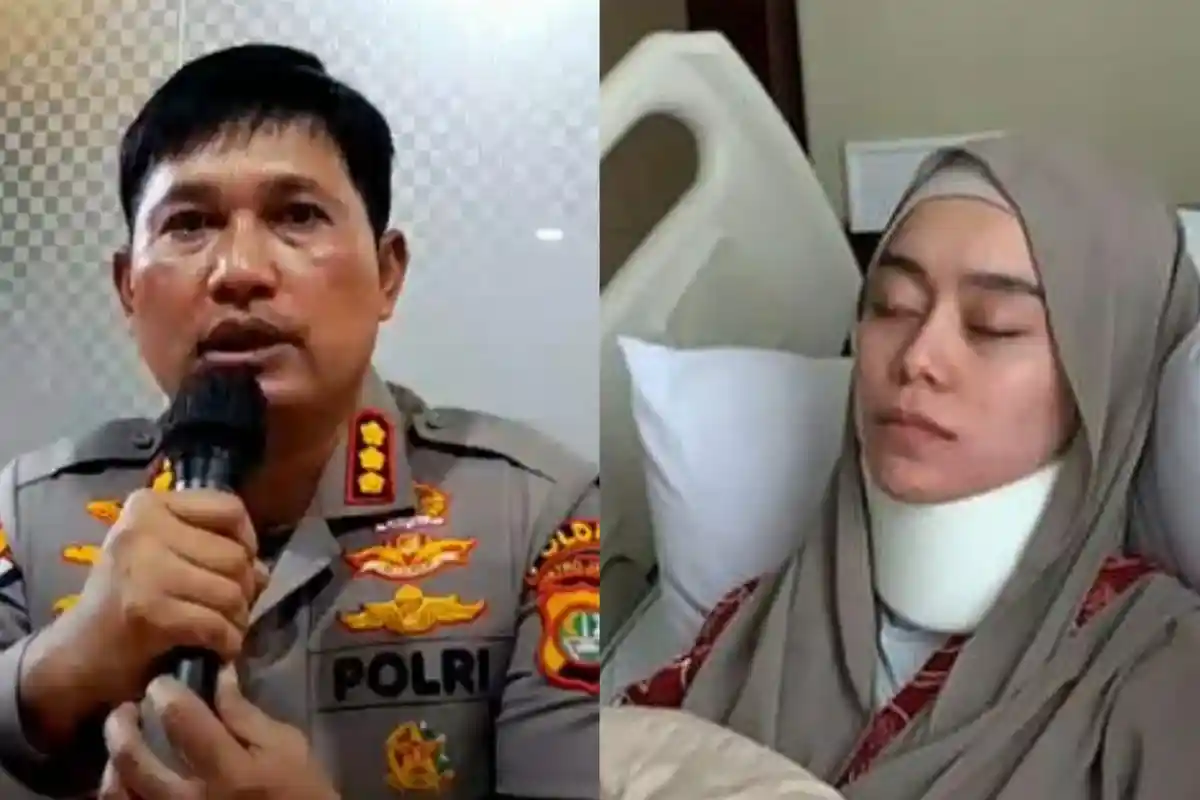 Leher Lesti Kejora Sampai Mengalami Gangguan Fungsi Karena Dicekik Rizky Billar, Ini Hasil Visumnya