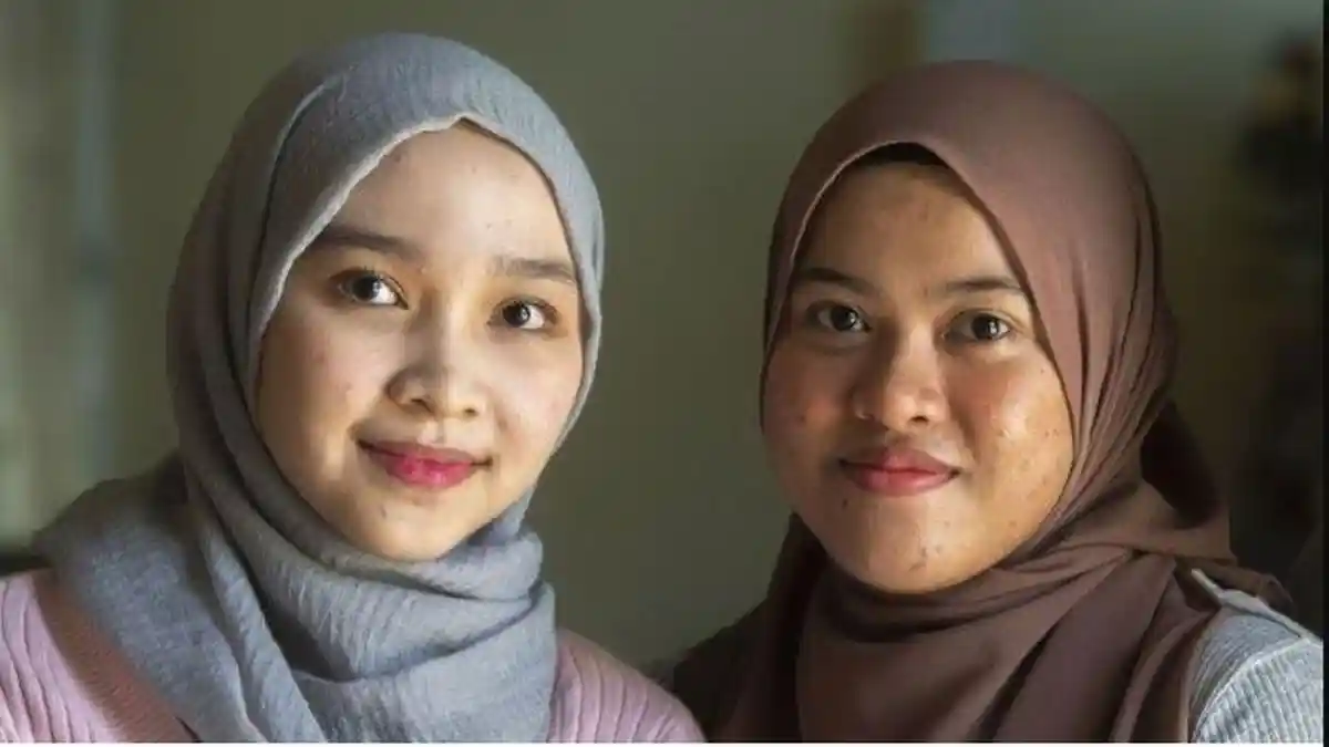 Hidup Sebagai Gadis Kembar Selama 19 Tahun, Ternyata Bukan Anak Kembar, Terungkap Usai Tes DNA