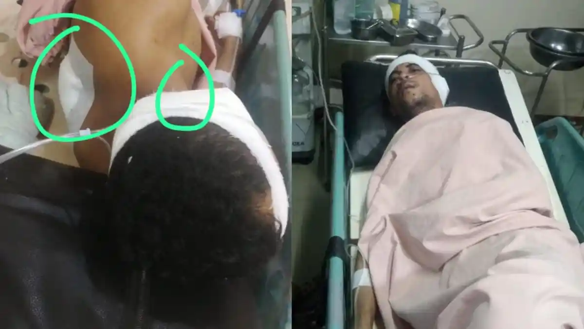 Begini Kondisi Pekerja Warung yang Ditikam Rekannya karena Sakit Hati