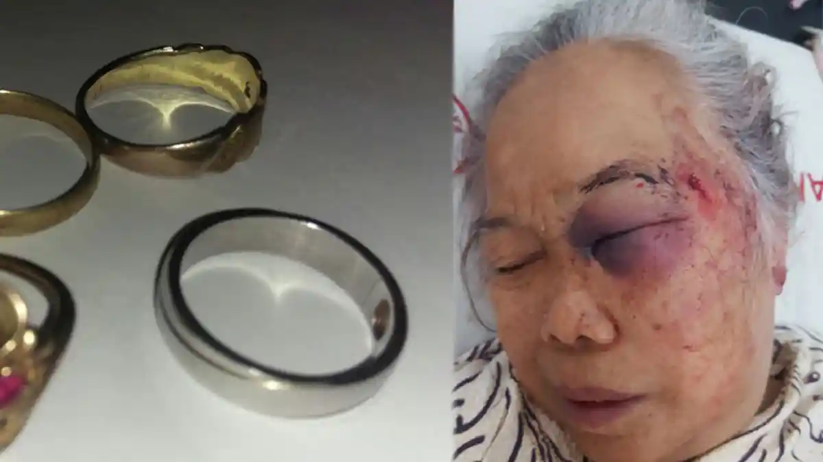 Astaga ! Hidup Seorang Diri Nenek Ini Dianiaya Perampok Sampai Pingsan