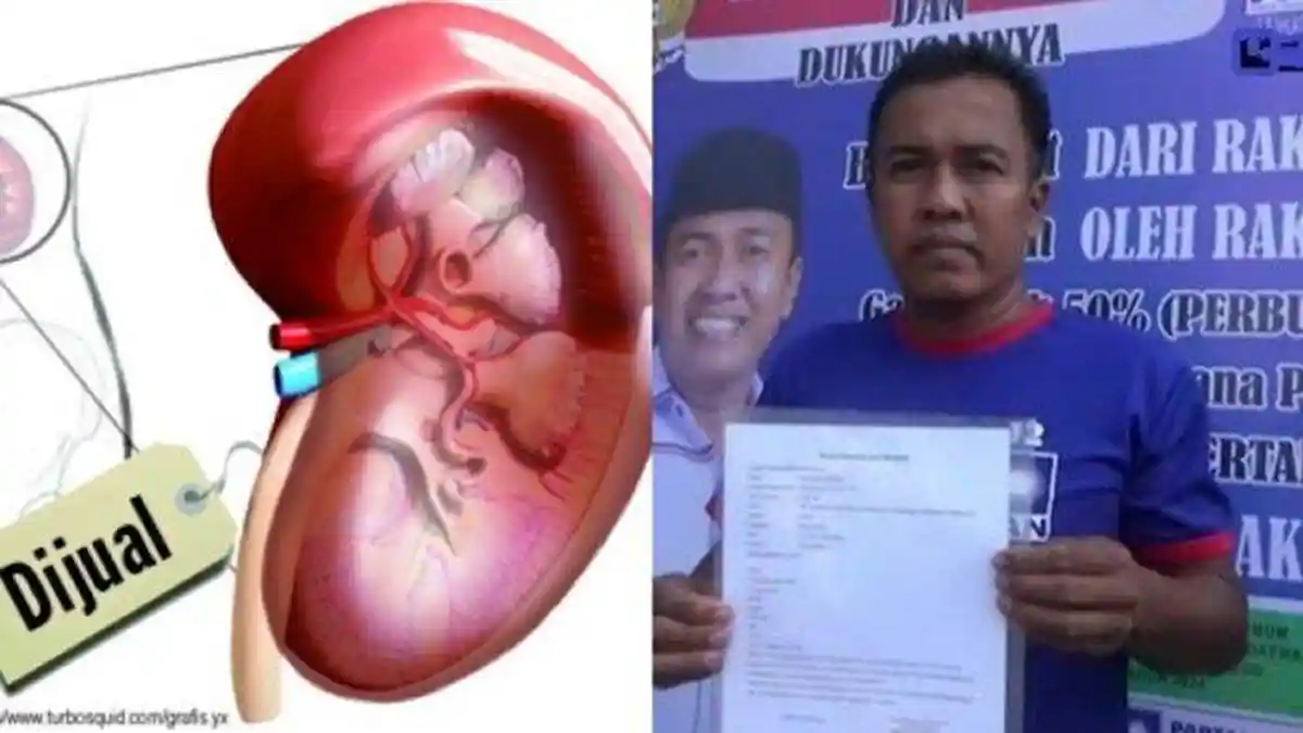 Ini Alasan Caleg DPRD Bondowoso Buat Surat Bermaterai Rela Jual Ginjal