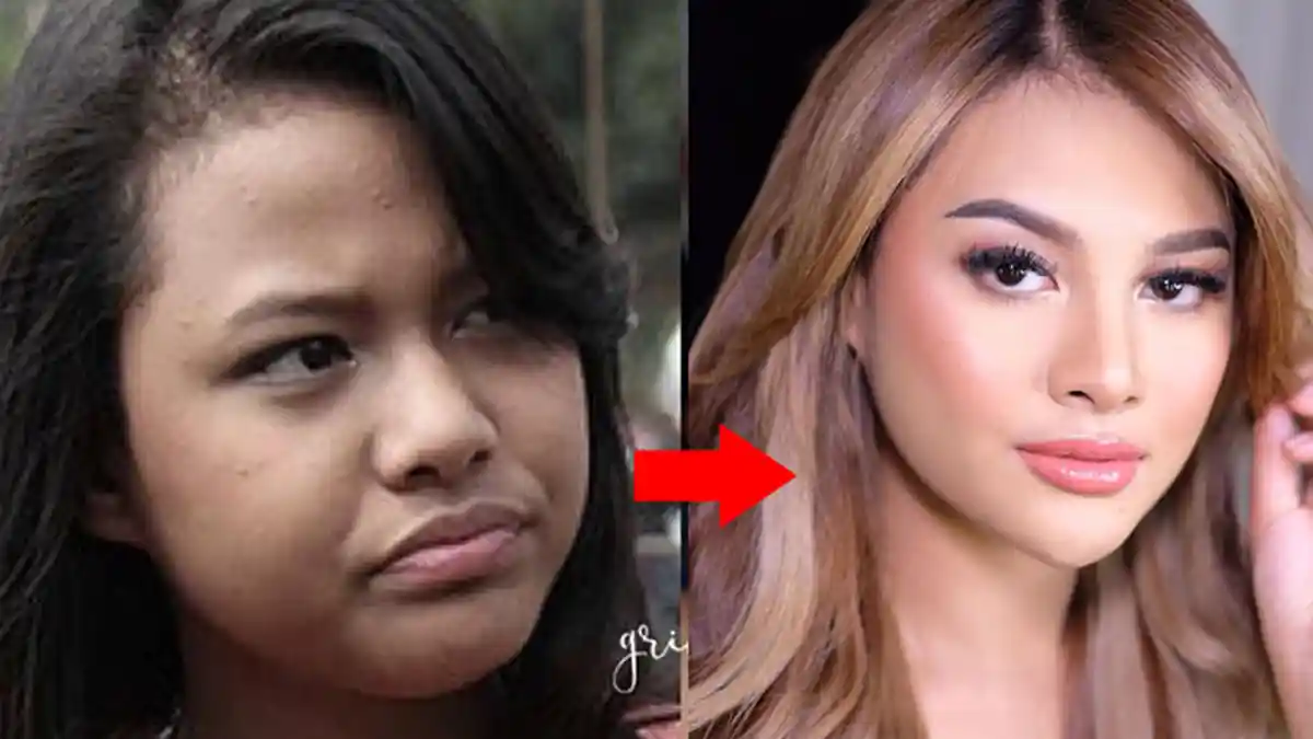 Kerap Dibully & Dituduh Operasi Plastik, Aurel Hermansyah Buka Suara Hanya Lakukan Ini Agar Cantik