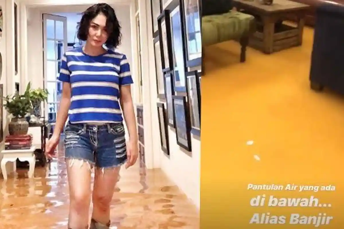 Kabar Buruk Yuni Shara Kena Musibah, Bagian Tubuh Mantan Pacar Raffi Ahmad Ini Justeru Jadi Sorotan