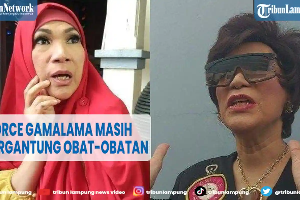 Kondisi Terbaru Artis Dorce Gamalama, Susah Makan dan Masih Tergantung Obat