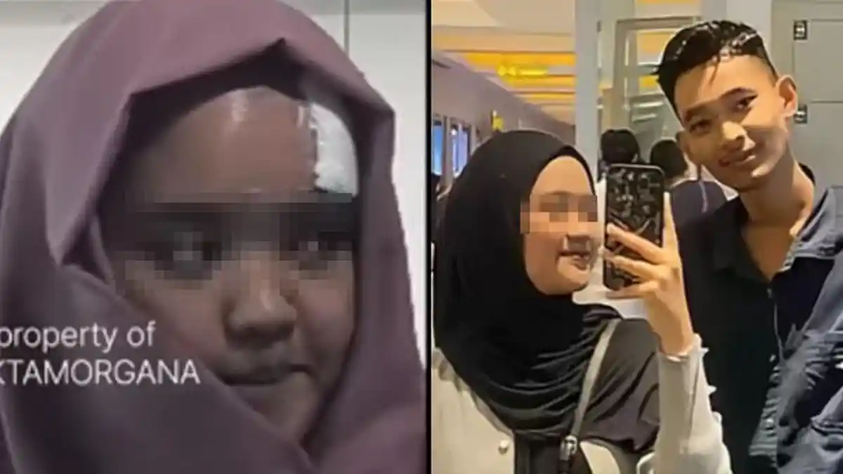 Penampilan Beda Fara Usai Dibacok Mahasiswa di Riau Disorot, Sang Pacar ...