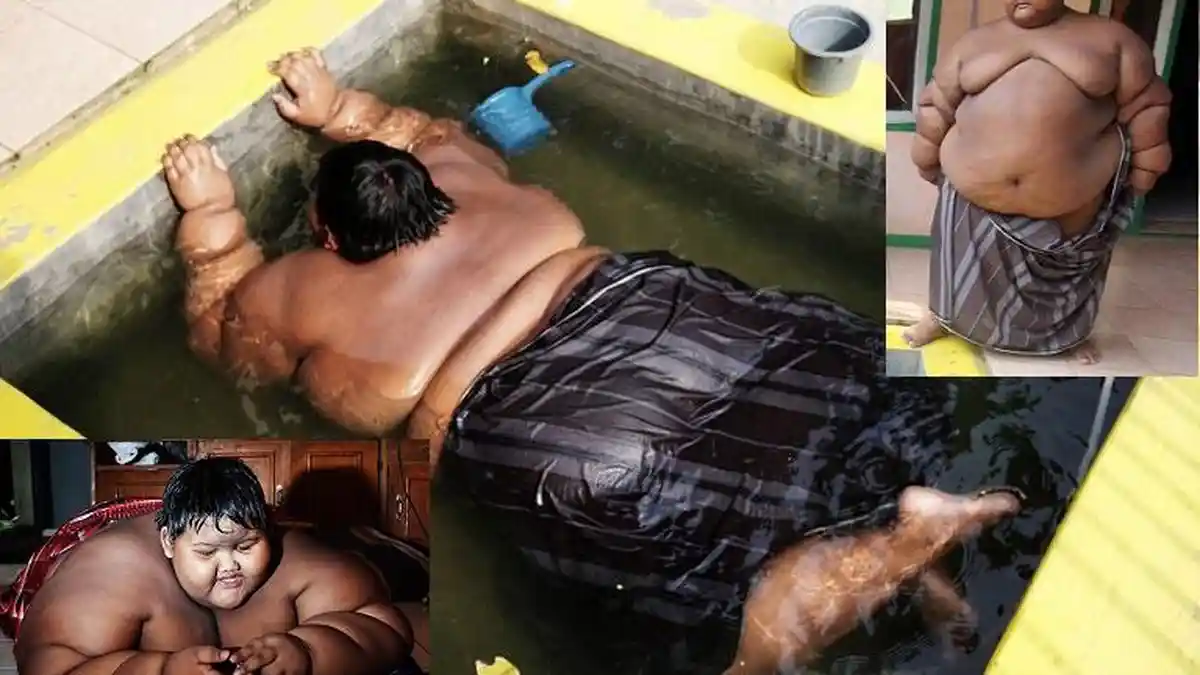 Ingat Arya Permana? Dulu Makan Dua Piring Setiap Lima Kali Makan, Bocah Obesitas Ini Berhasil Kurus!