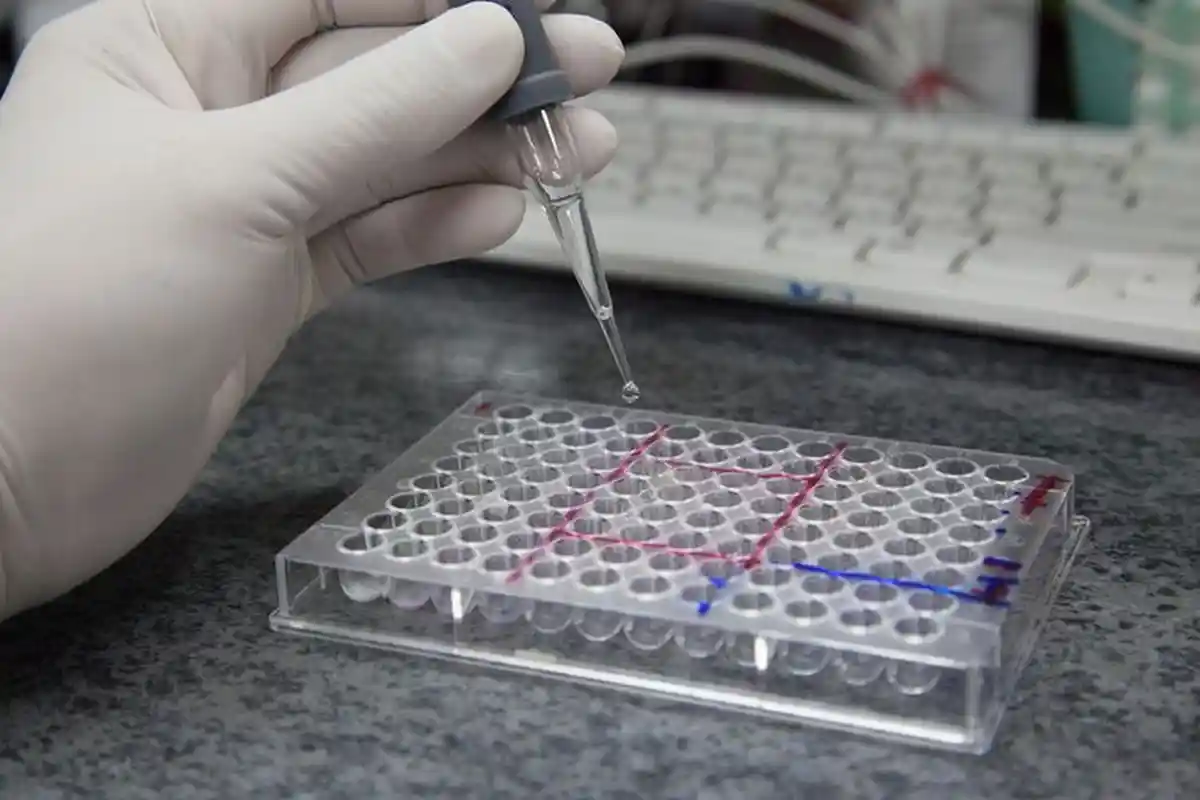 Punya Akurasi Tinggi, Rapid Test Buatan Indonesia Ini Hanya Dibanderol Rp 75 RIbu