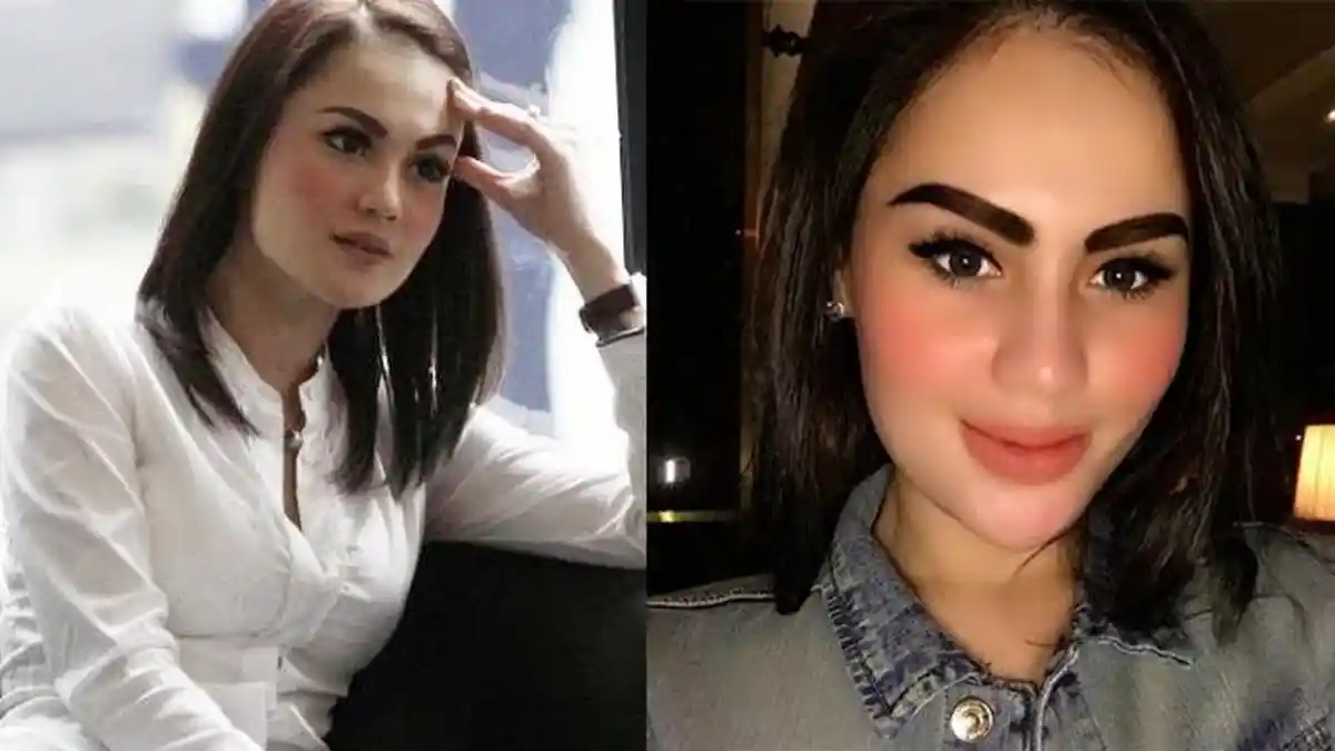 Seram Abis! Habis Sedot Lemak, Penampilan Jennifer Dunn Malah Bikin Netter Ketakutan, Mirip Hantu?