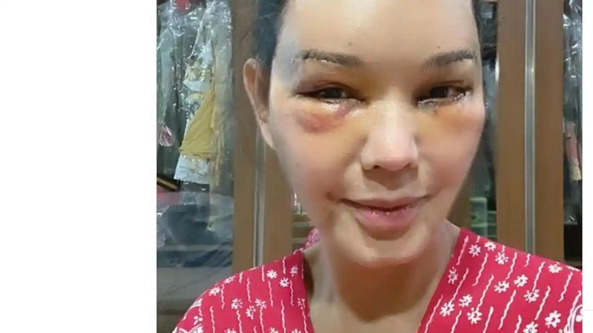 Setelah Oplas, Bunda Corla Merasa Wajahnya Mirip Siti Nurhaliza