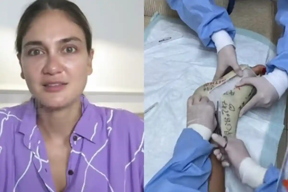 Gips di Kakinya Baru Saja Dibuka, Luna Maya Mengaku Sudah Tak Sabar Bisa Bersepeda Lagi