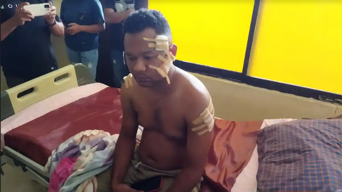 Korban Penikaman di Belu Minta Pelaku Oknum Brimob Diproses Hukum 