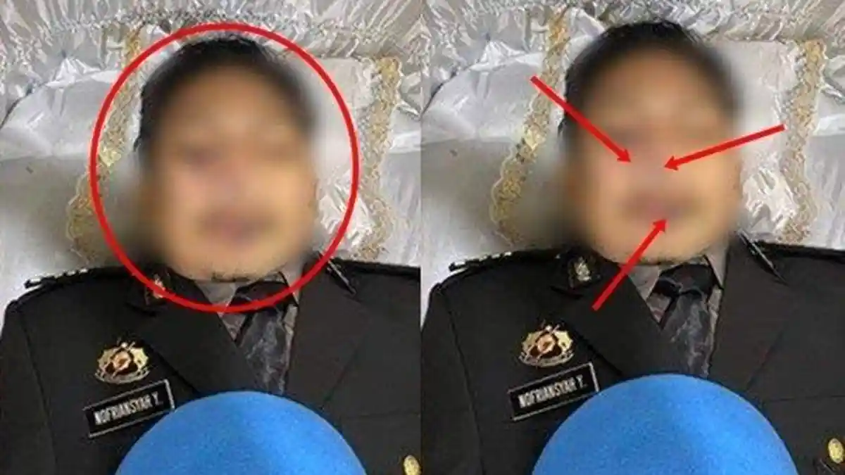 Otopsi Ulang Jenazah Brigadir J, Polri Sebut Libatkan 7 Dokter Forensik dari Eksternal