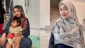 Kolase-perbandingan-wajah-Ria-Ricis-sesudah-dan-sebelum-oplas.jpg