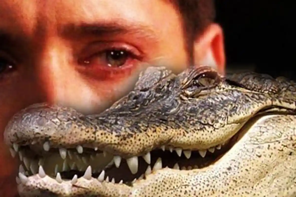 PILU Pria yang Menderita Sindrom Air Mata Buaya, Nggak Bisa Berhenti Nangis Saat Sedang Makan