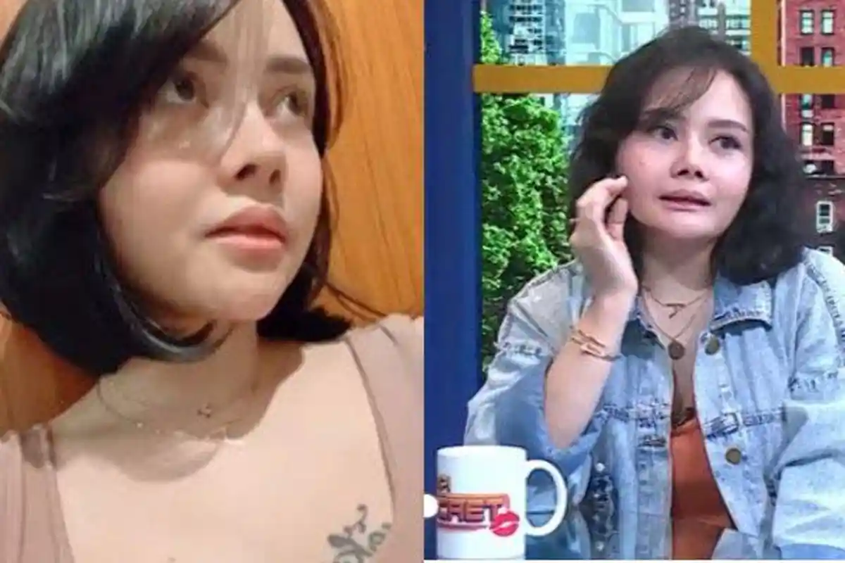 Mawar AFI Kini Berubah Drastis setelah Jalani Operasi Rahang, Wajahnya Beda