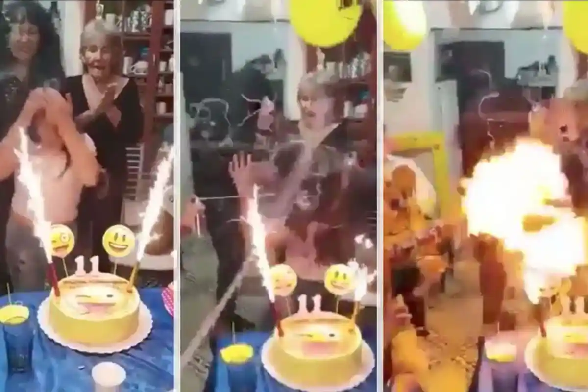 Api Berkobar di Atas Kepalanya, Perayaan Ulang Tahun Gadis ini Nyaris Menjadi Malapetaka