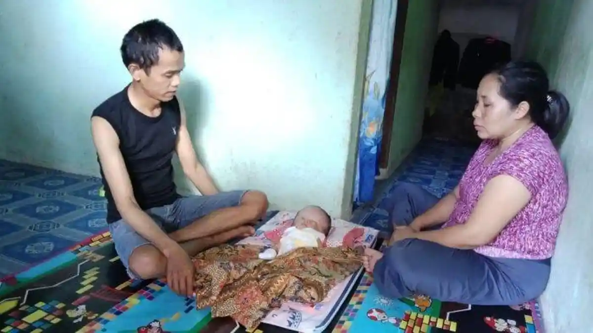 Kepala Bayi di Pematang Kandis Ini Terus Membesar, Diduga Menderita Hidrosefalus