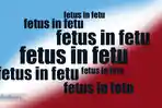 ilustrasi-fetus-in-fetu.jpg