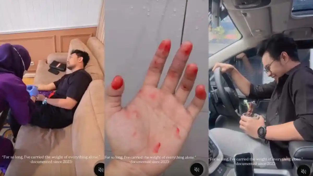 Curhat Kerasnya Hidup, Insanul Fahmi Dicap Bocil Alay, Unggah Video Teriak dengan Tangan Berdarah