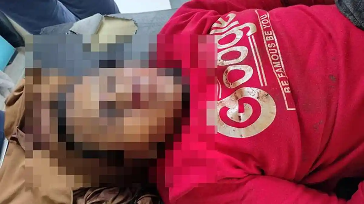 Wanita ini Jadi Korban Tabrak Lari di Amplas, Mayatnya Berada di RS Bhayangkara Tak Ada yang Jemput 