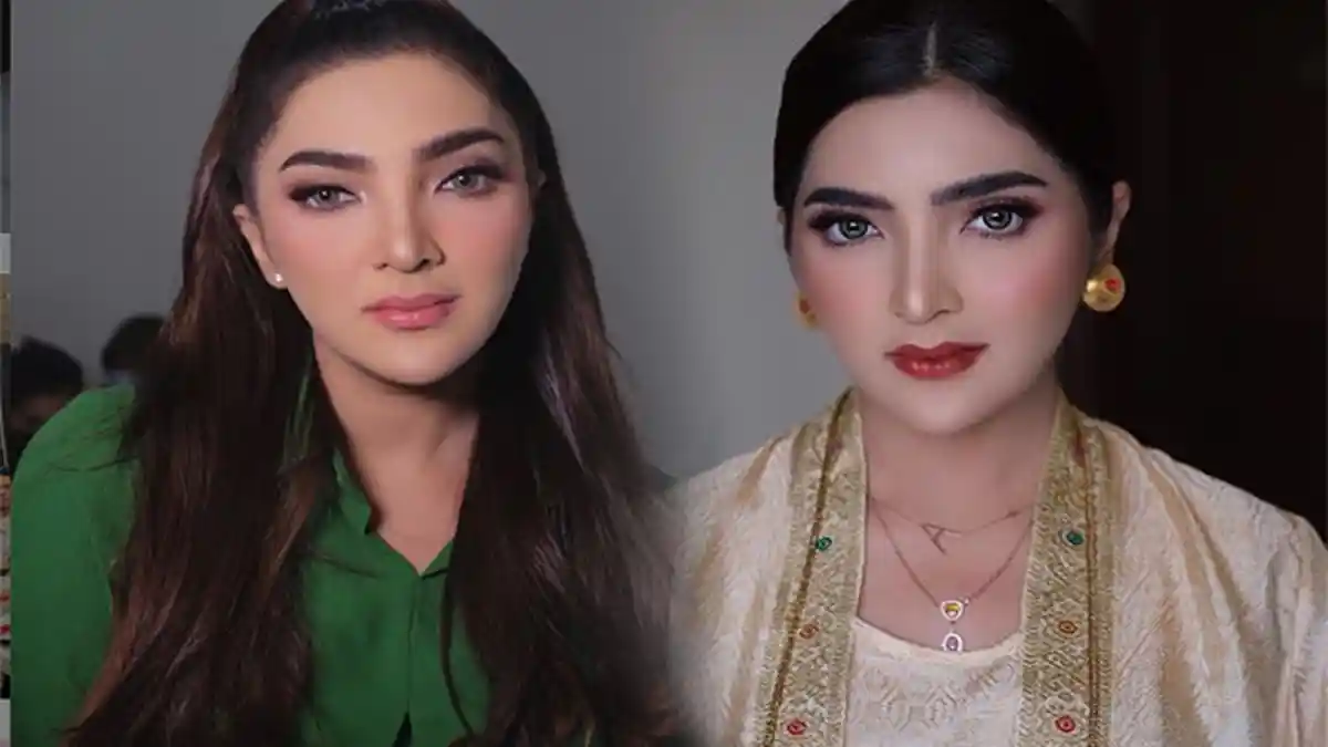 RAMBUT Ashanty Rontok Parah Setiap Hari Akibat Penyakit Langka Dideritanya