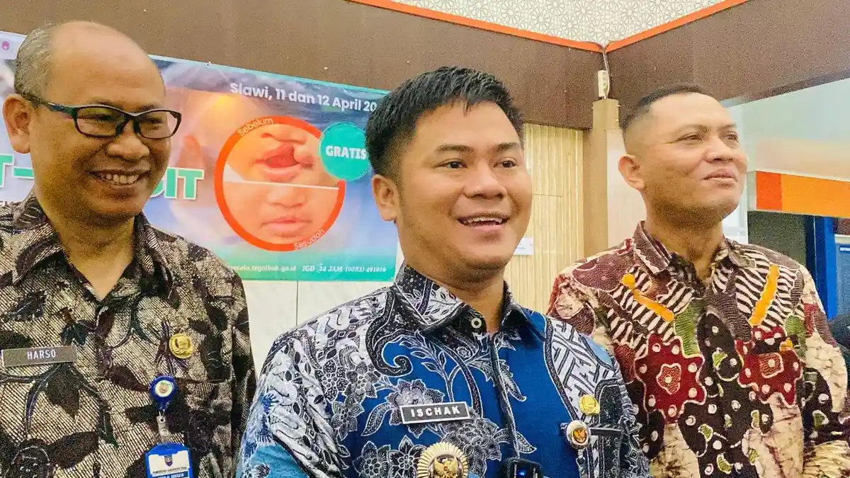 Benarkan Asap Rokok Bisa Sebabkan Anak Alami Bibir Sumbing