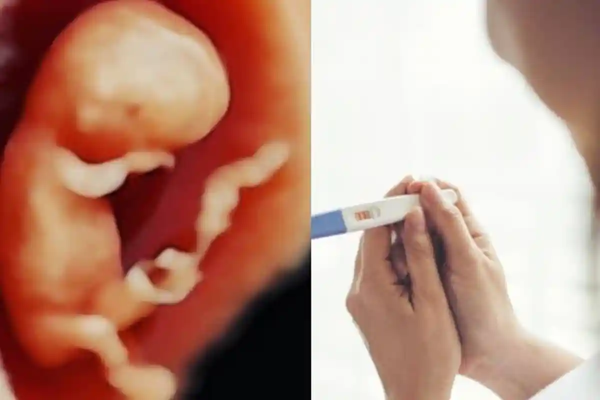 Wanita Syok Hamil Baru 18 Minggu Perut Bak 8 Bulan, 'Bayi Mulai Gerak Bun', Tak Dirasa Kulit Menebal