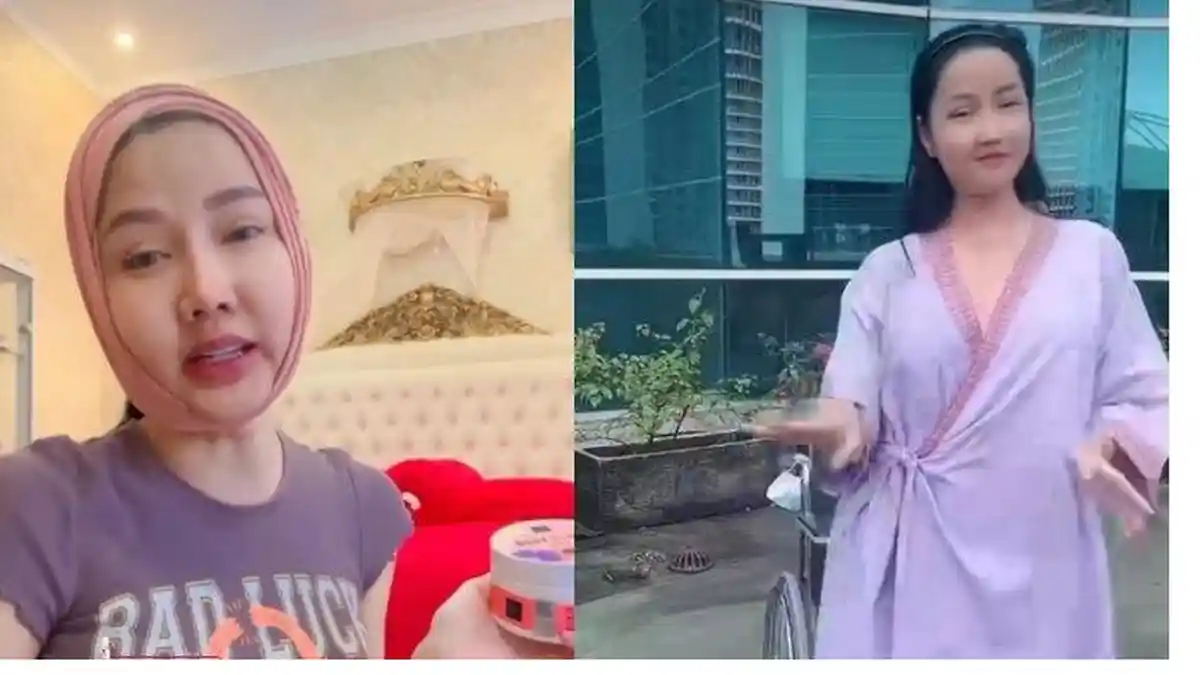 Wajahnya Bengkak Akibat Gusi, Lucinta Luna Malah Pamer Joget: Banyakin Gerak Biar Cepat Sembuh