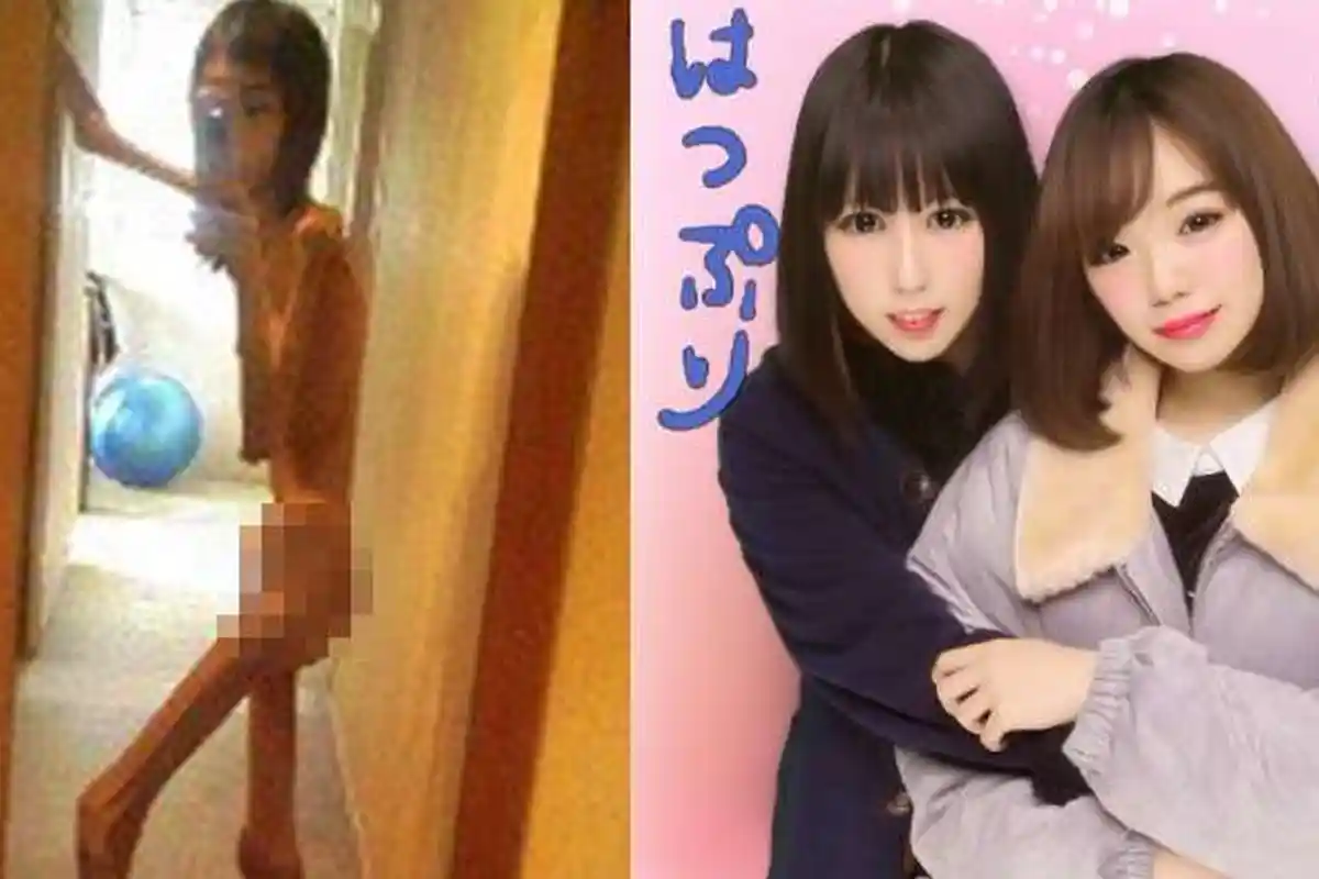 Malang, Wanita Ini Disiksa Kakeknya Tanpa Diberi Makan Hingga Kurus Kering Begini