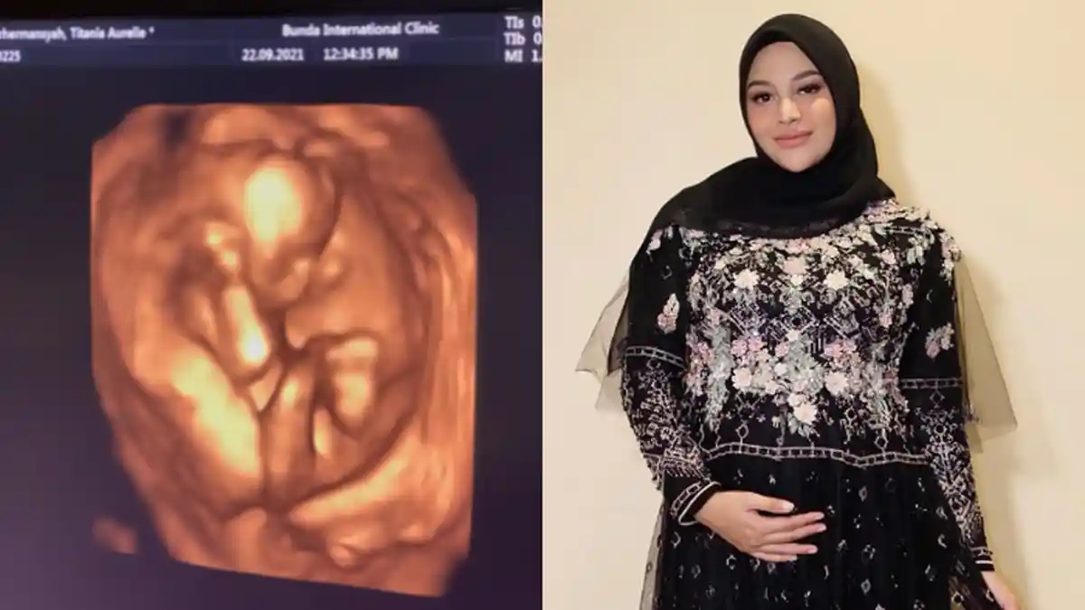 Hamil 4 Bulan, Aurel Hermansyah Takjub Lihat USG Baby AH, Atta Halilintar: Dia Bisa Buka Mata?