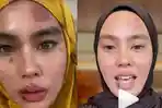 Penampakan-Wajah-Baru-Kartika-Putri-Sembuh-Usai-Berobat-ke-Singapura-Bantah-Kena-Penyakit-Ain.jpg