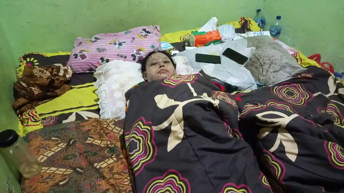 Alami Penyakit Kulit Langka, Warga Bermani Ulu Raya Terbaring Lemah dan Tak Bisa Menyusui Anaknya