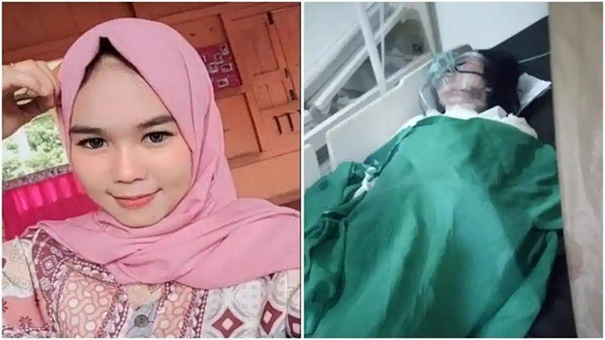 Istri Hamil, Punya 2 Anak, Oknum Polisi Ini Masih Selingkuh, Tak Terima Diputus Bakar Sang Pacar