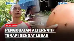Pengobatan-Alternatif-Terapi-Sengat-Lebahaa.jpg