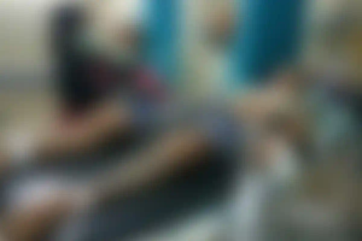 Terjangkit Rabies, Nyawa AA Gede Tak Tertolong