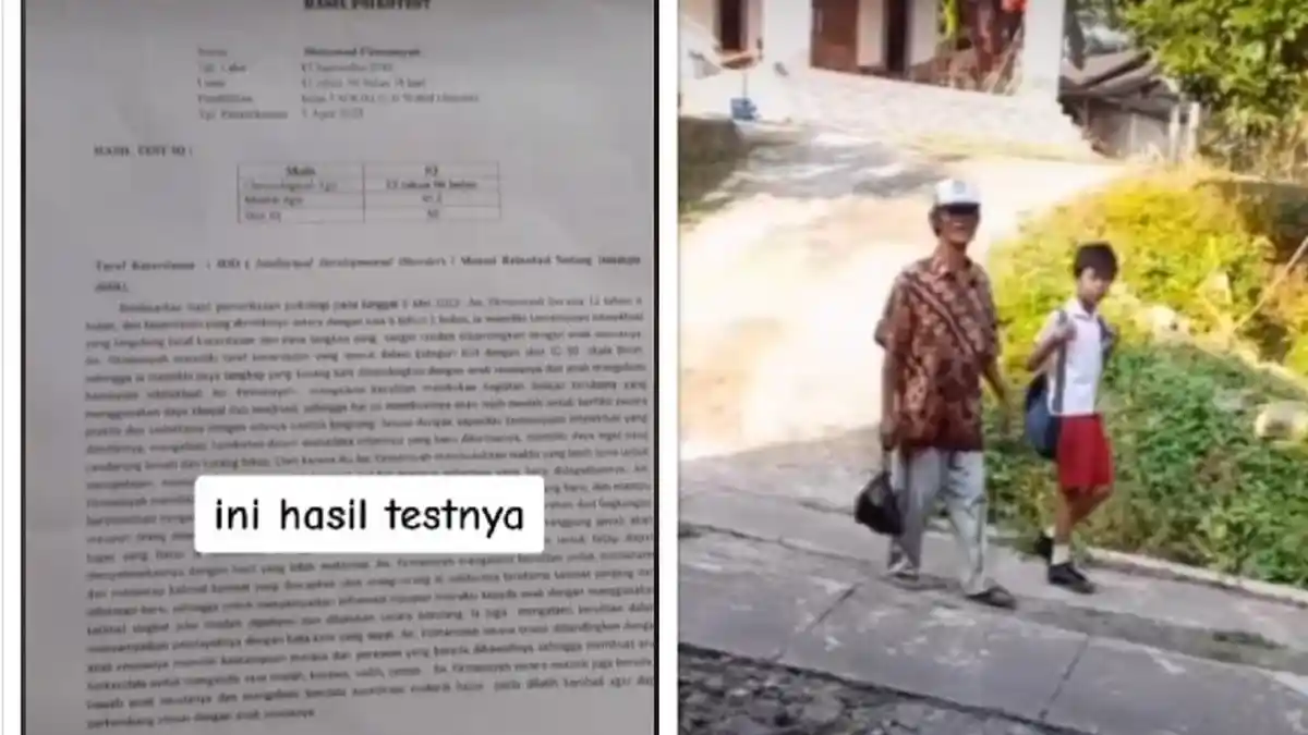 Update Terbaru Firmansyah Bocah SD yang Harus Sekolah di SLB, Tes Psikolog Hanya Dapat Nilai 50