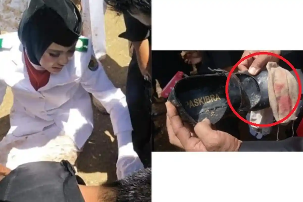 Ceritanya Viral di FB, Kata Paskibra yang Kakinya Tertusuk Paku dan Tahan Sakit: Tugas Saya Tunaikan