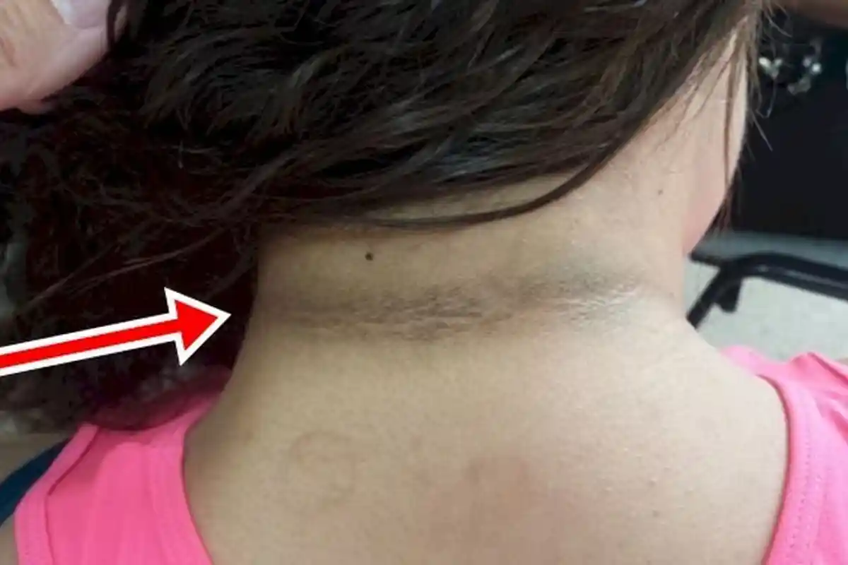 5 Bahan Dapur Rumahan Ini Bisa Putihkan Leher, Tanpa Ribet Butuh Waktu 10 Menit Saja Guys