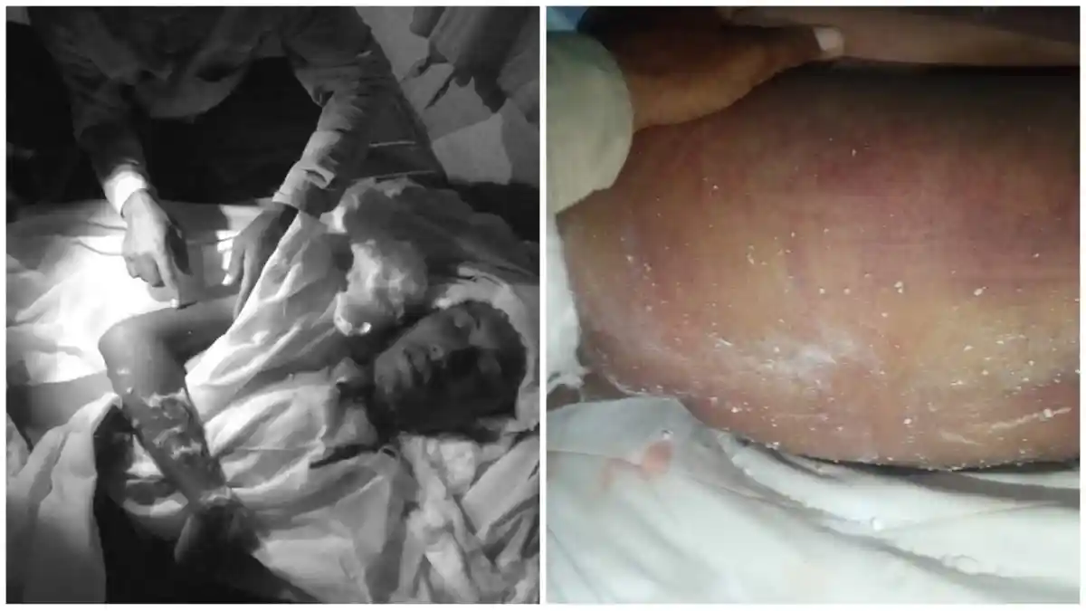 Polisi Bilang Gantung Diri, Tapi Tahanan yang Mati di Ruang Pejabat Polres Penuh Lebam