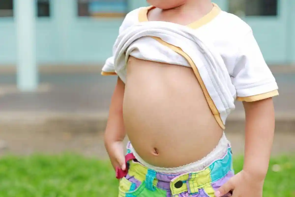 Balita Raya Warga Sukabumi Meninggal Cacingan, Cacing Keluar dari Mulut dan Hidung, KDM Kecewa Berat